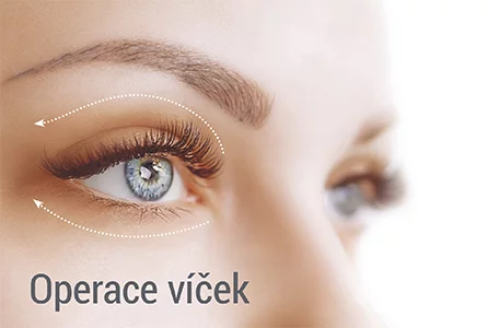 Vraťte svým očím mládí pomocí operace očních víček